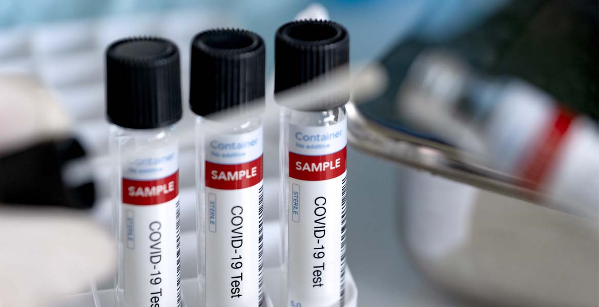 Canada Eases COVID-19 Covid Testing Requirements